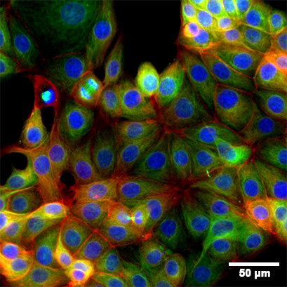 Fluorescence microscopy of immunostained MCF-7 cells
