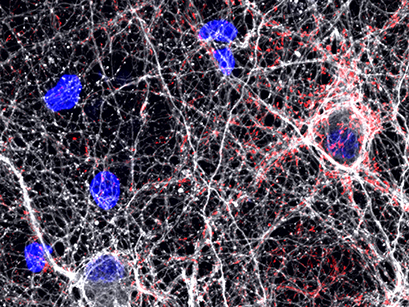 IF_neurons_astrocytes.jpg