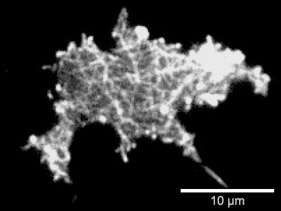 Surface-near F-actin network of a Dictyostelium discoideum DdLimE-GFP cell