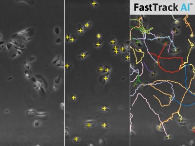 Chemotaxis FastTrack AI Image Analysis