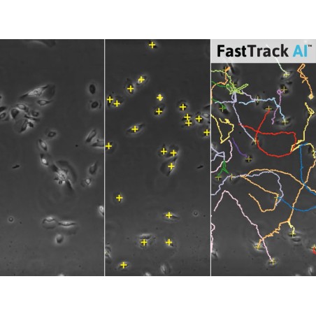 Chemotaxis FastTrack AI Image Analysis