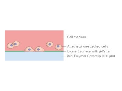 Custom µ-Pattern ibiTreat