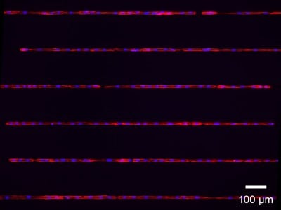 μ-Slide VI 0.4 μ-Pattern ibiTreat, lin20, pit170