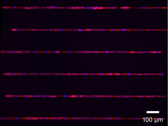 μ-Slide VI 0.4 μ-Pattern ibiTreat, lin20, pit170