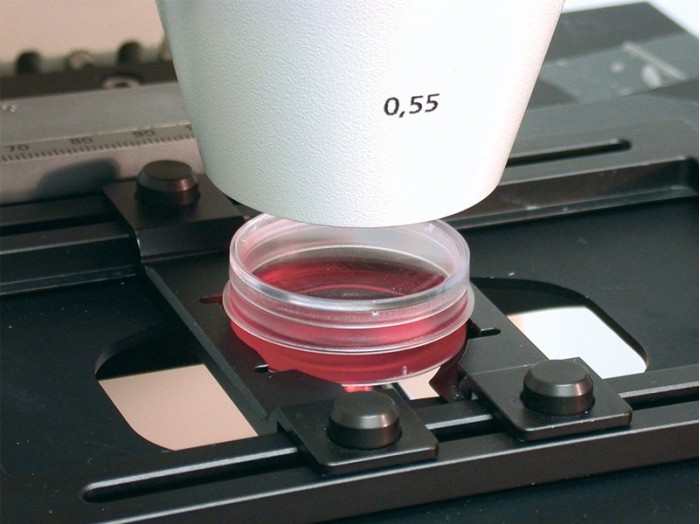 µ-Dish 35 mm, high ESS | Soft Cell Culture Surface | ibidi