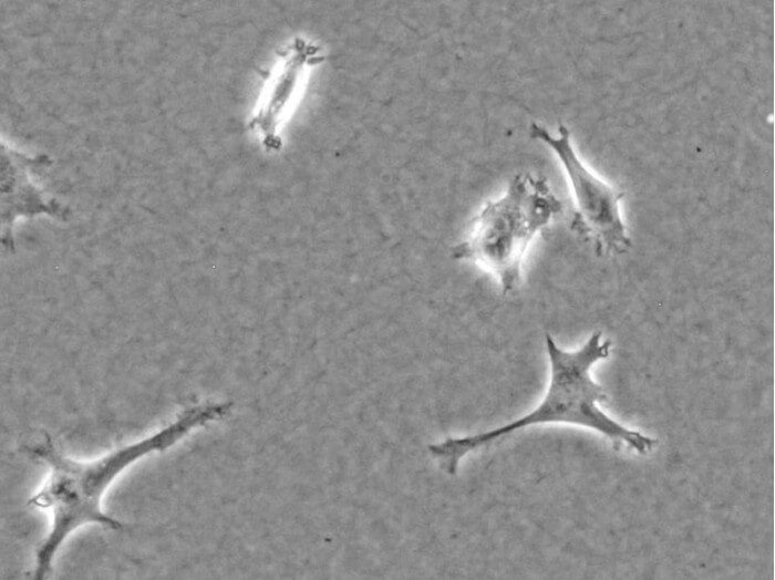 Collagen Type I, Rat Tail 3D Cell Culture Gels & Coating ibidi