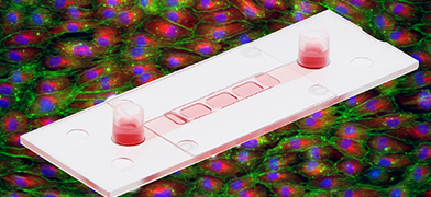 ibidi Product News:  Culture Cells on a 3D Gel With Defined Flow
