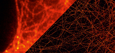 ibidi’s µ-Slides are as Effective as Glass Slides in Live Cell Super-Resolution Microscopy