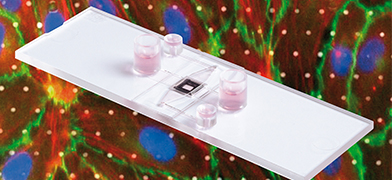 Transmigration and Transport Studies Through a Porous Glass Membrane – Introducing ibidi’s µ-Slide Membrane ibiPore Flow