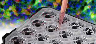 ibidi_pr_2025_08_m_plate_membrane_inserts_392.jpg