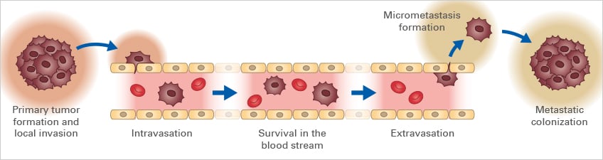 C_invasion_metastasis.jpg