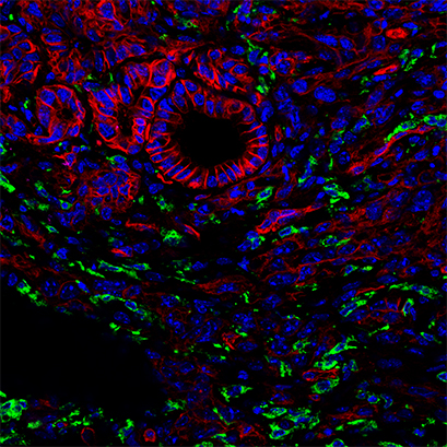 Confocal microscopy of tumor-associated macrophages