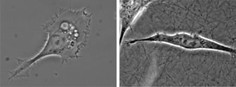 Microscopy of adherent HT-1080 cancer cells