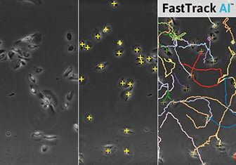 Tube Formation ACAS Image Analysis