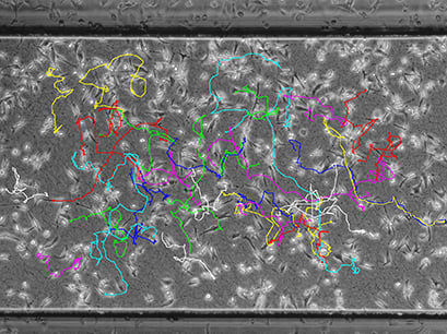 Cell Tracking