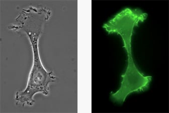 A chemotactic HT-1080 LifeAct-TagGFP2 cell migrating on a 2D surface.