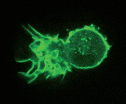 Murine dendritic cell with LifeAct-labeled F-actin