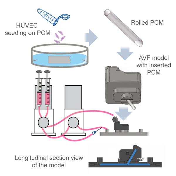 Disturbed flow in a custom in vitro arteriovenous fistula model