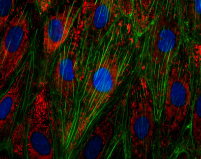 Immunofluorescence staining of the von-Willebrand-Factor