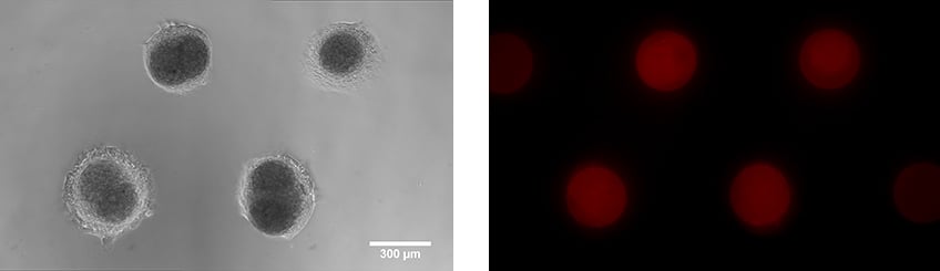 oem_mp_example_NIH-3T3_3D_spheroids.jpg