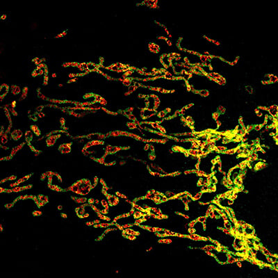 COS7 mitochondria super resolution