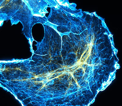 COS7 cytoskeleton super resolution