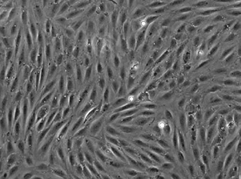 RAT1 cells on the ibidi Polymer Coverslip coated with Collagen IV.
