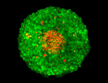 confocal microscopy