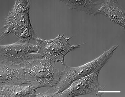 differential interference contrast microscopy