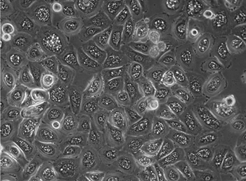 Human primary keratinocytes on the ibiTreat ibidi Polymer Coverslip