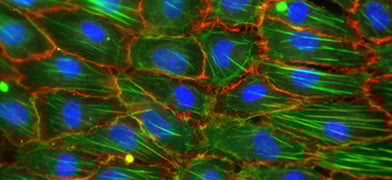 3 Reasons Why You Should Cultivate Endothelial Cells Under Flow