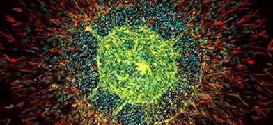3D Cell Culture Models – An Overview
