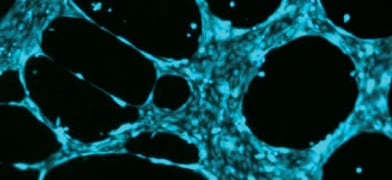 Vessels of Life: How Angiogenesis Shapes Health and Disease