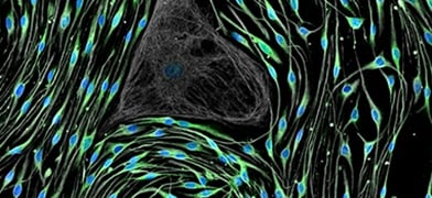 ibidi Mini Review: Cell-Based Imaging Methods for Investigating the Structure and Function of Neuronal Cells