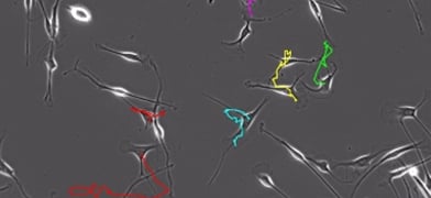 5 Tips for Preparing Primary Cells from the Peripheral Nervous System for Live Cell Imaging