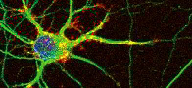 5 Versatile In Vitro Assays To Study Neurological Conditions