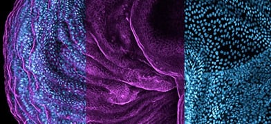 Organoids: The Miniature Labs