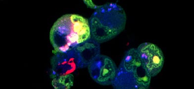 The Patient in Focus: How to Use Cell Assays for the Discovery of New Cancer Therapies