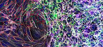 The Placenta: Here for a Good Time, Not a Long Time