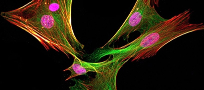 5 Crucial Steps for Obtaining a Great Immunofluorescent Cell Image