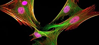5 Crucial Steps for Obtaining a Great Immunofluorescent Cell Image