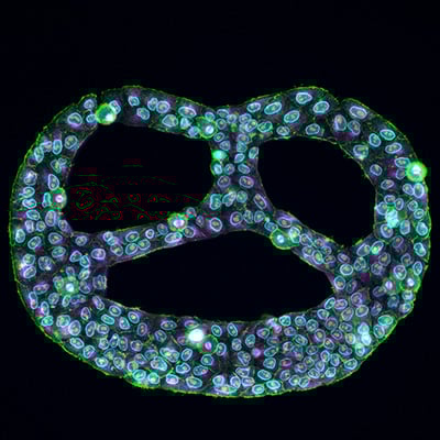 Multiplex immunofluorescence image of HeLa cells confined to defined adhesive micropatterns on a µ-Slide VI 0.4 µ-Pattern.