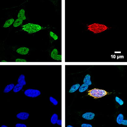 SHSY5Y_FUS_knockout_cells_gadgil.jpg