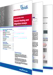 Wound Healing and Migration