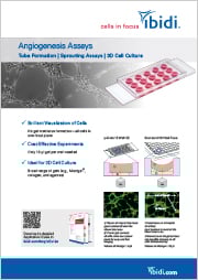 FL_102_Angiogenesis.jpg