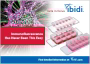 PC_433_Immunofluorescence.jpg