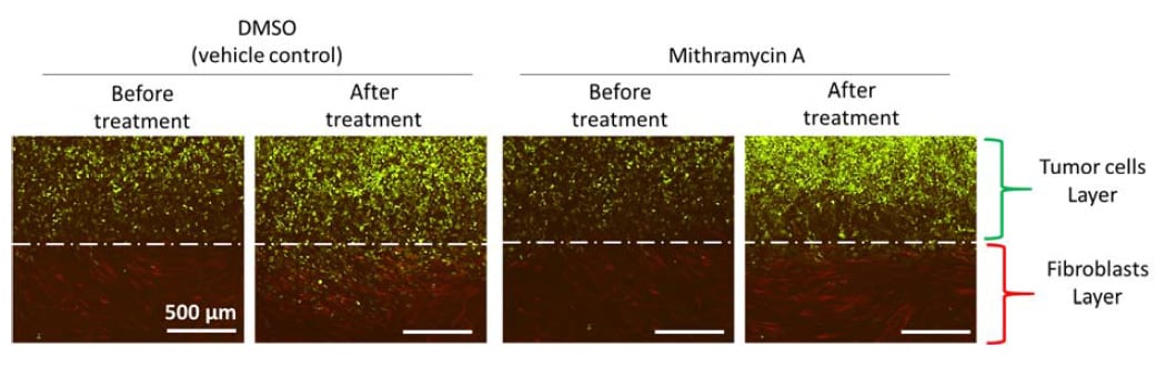 Fluorescent images of 2D invasion assays