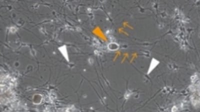 UP 07: Protocol for DRG Neuron Preparation