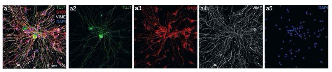 Confocal image analysis of immunostained DRG cultures