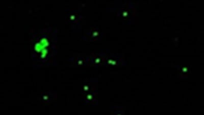UP 08: Protocol for an Adhesion Assay Using Cell Culture Under Unidirectional Flow
